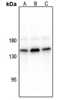 WB - Anti-CD117 (pY936) Antibody AP61141